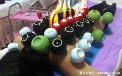 拔罐一个月瘦20斤亲身经历,对于过度肥胖的