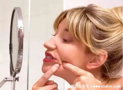 挤痘痘竟导致瘫痪？奥络夫西地酸乳膏教你正确的祛痘方式