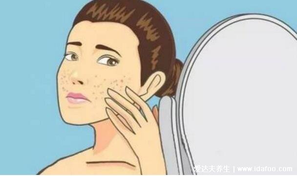 晒伤后皮肤发红疼痛怎么办,5个晒后修复的方法亲测有效