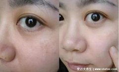 开塞露可以擦脸吗，开塞露擦脸有什么效果