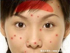 脸上长痘痘的位置图解，不同位置对应不