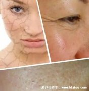 每天坚持敷面膜五年后,皮肤敏感依赖性皮