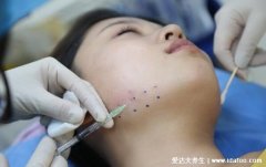 瘦脸针的危害有什么副作用,一般都是轻微