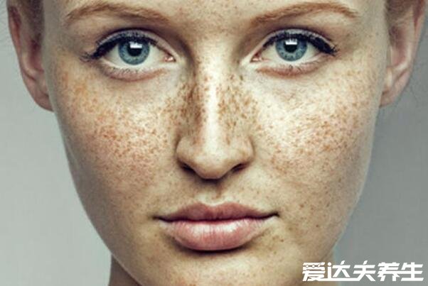 维生素e软胶囊涂脸可以淡斑吗,用的好淡斑用不好长痘
