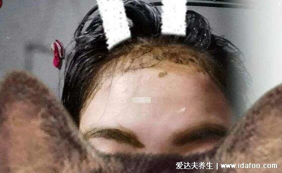 乌斯玛草棒能生发吗,涂眉毛效果会更好(可能有副作用)