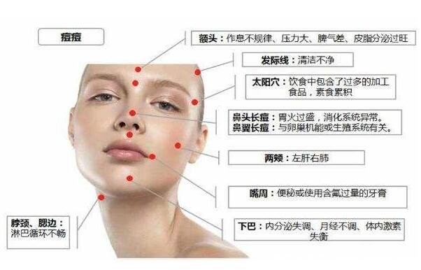 长痘痘的位置图解，长痘暗示身体出现了问题(唇周与便秘有关) 