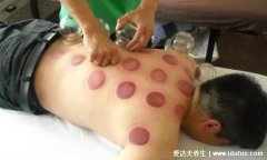 拔罐后黑紫是湿气重吗,是的/皮肤颜色越深