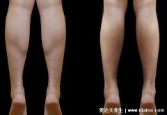 在学校怎样瘦腿,试试按摩或者背靠墙站立