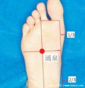 拔罐可以改善男人早射,刺激5大穴位提高男