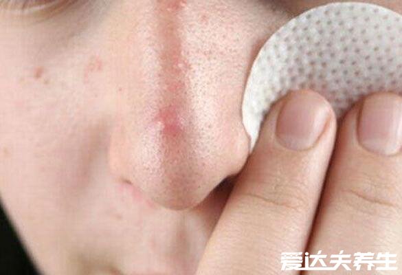 脸部长痘对应五脏的图,可不是内分泌失调那么简单