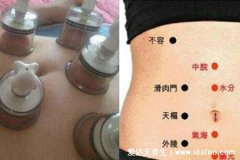 正确拔罐减肚子图一般拔多久,小于15分钟效