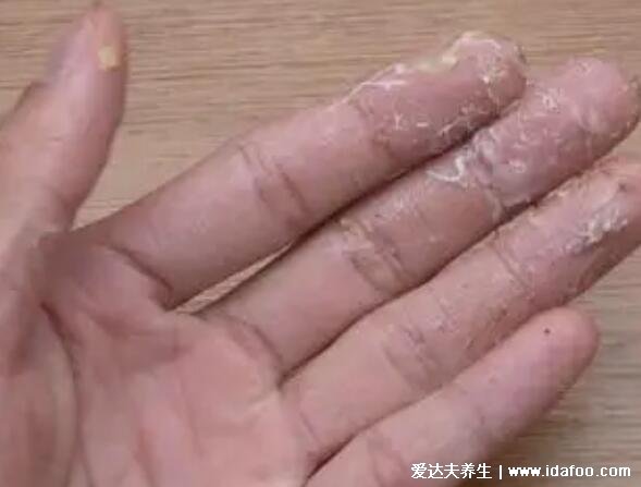 菠萝蜜怎么剥皮小窍门,简单3步快速剥皮有视频(附粘手洗掉的方法)
