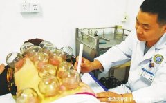 湿气重的人怎么排湿,拔罐/艾灸/运动/饮食