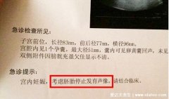 12周胎停后又活胎了可能吗，和人死不能复活